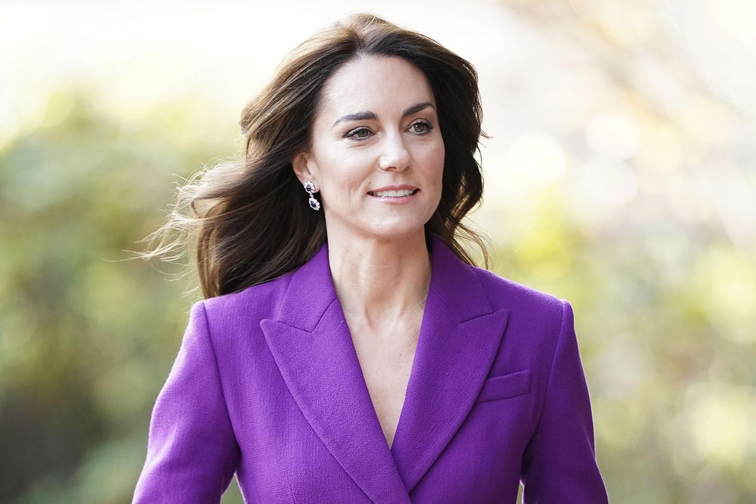 Mengungkap Kondisi Kesehatan Kate Middleton Proses Operasi Perut Yang Dilaluinya Esatuid